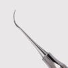 Nevi 3 Posterior